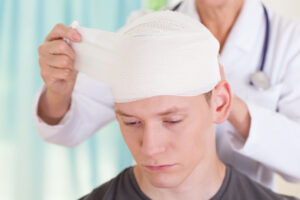 How The Law Firm of Alton C. Todd Can Help After Suffering a Brain Injury in Friendswood
